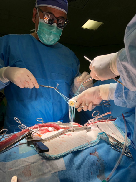 Dr. Mohammad Hassan Nezafati during heart surgery